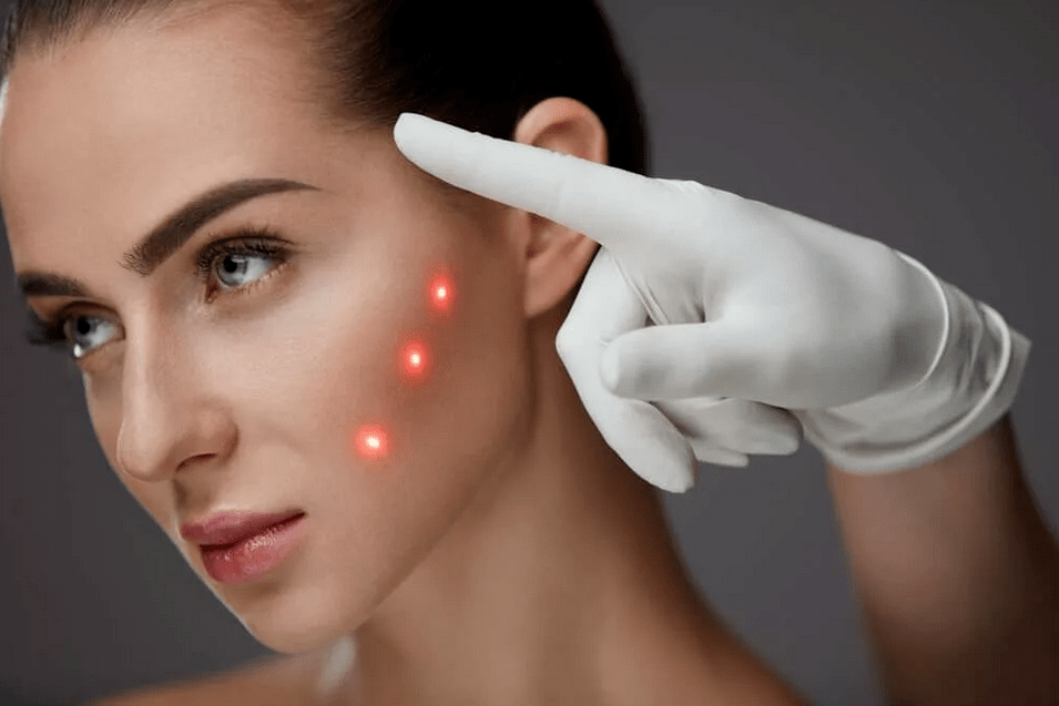 gençleştirme yöntemleri